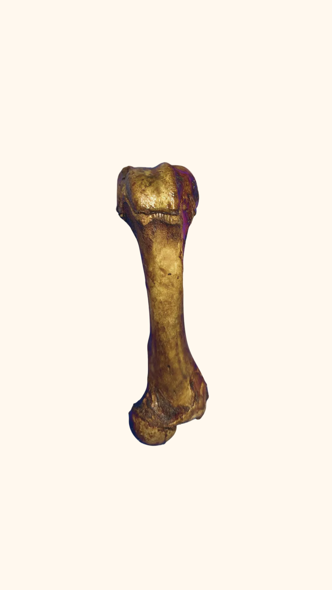 Femur Bone